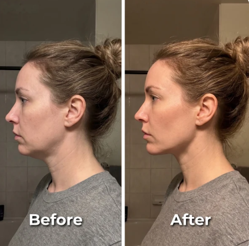 Lymphatic Face Massager